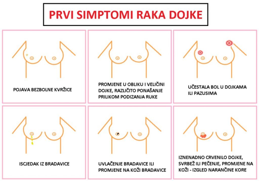 Prvi simptomi raka dojke